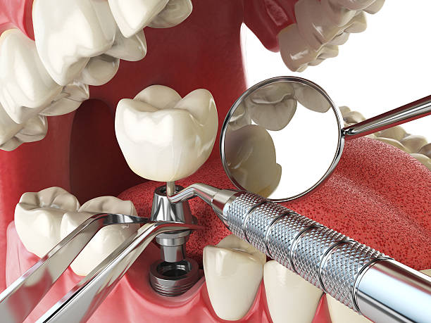 Best Emergency Orthodontic Repairs in St Michaels, MD
